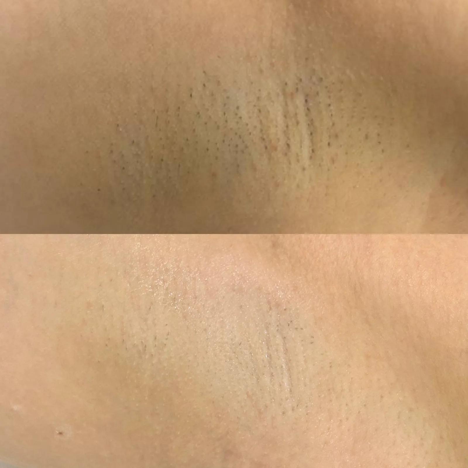 Before and after result 3 visits