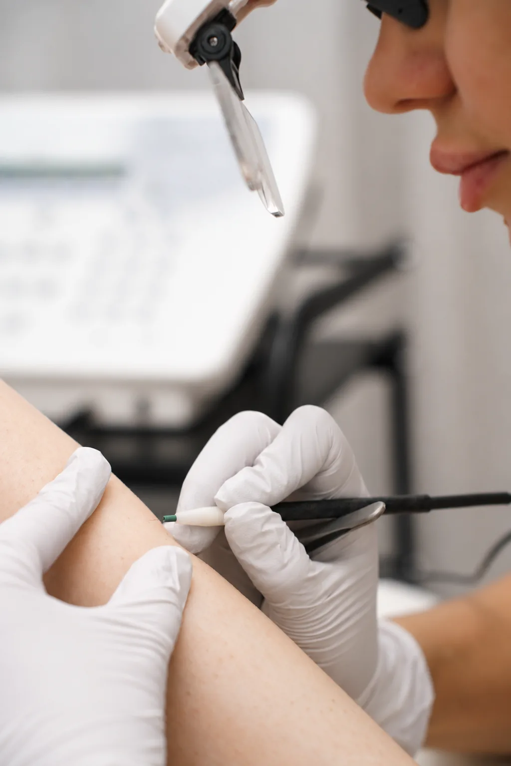Specialist performs electrolysis on a client's forearm
